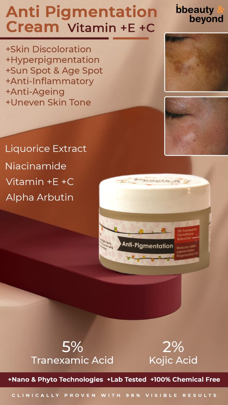 Anti Pigmentation Cream Vitamin +E +C